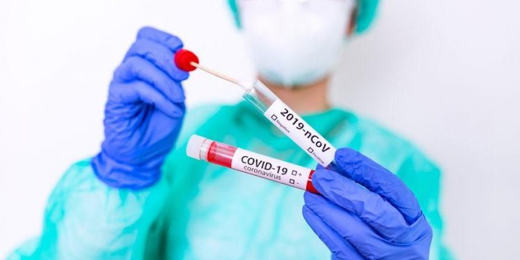 Seluruh Anggota DPRD Ikuti Swab Test Massal