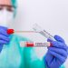 Penumpang Meningkat, Rapid Tes Antigen di Bandara Diperketat