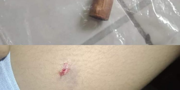 Saat Tidur Nyenyak, Seorang Pelajar SMK Terkena Peluru Nyasar