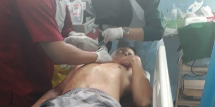 Begal Beraksi di Kapuas, Dua Korban dengan Kondisi Bersimbah Darah