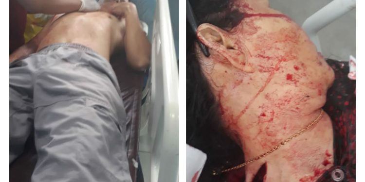 Polisi Masih Selidiki Pelaku Pembunuhan Ibu dan Penganiayaan Anak di Kapuas