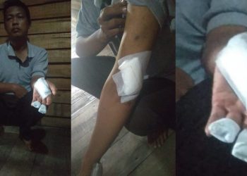 Diancam Akan Dibunuh, Adek Bacok Kakak Kandungnya Sendiri Pakai Parang