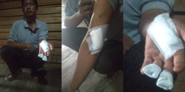 Diancam Akan Dibunuh, Adek Bacok Kakak Kandungnya Sendiri Pakai Parang