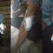 Diancam Akan Dibunuh, Adek Bacok Kakak Kandungnya Sendiri Pakai Parang