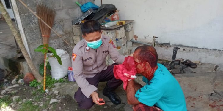 Usai Bacok Dua Temannya Sendiri, Pelaku Kabur Melarikan Diri